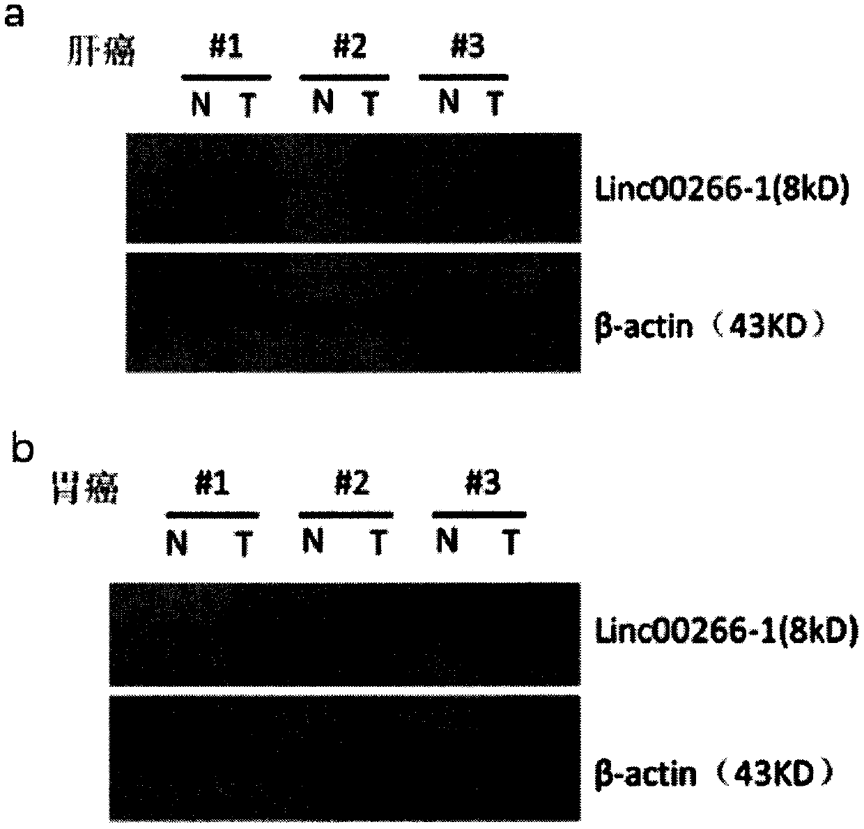 Application of LINC00266-1 polypeptide as solid tumor marker