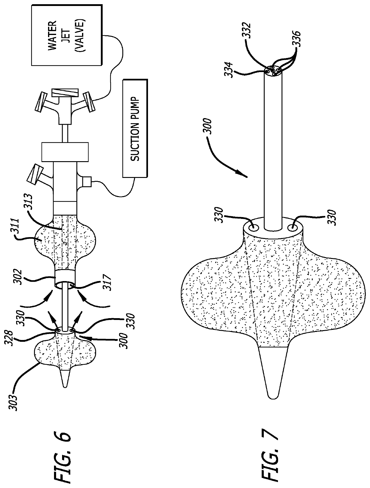 Pulmonary Embolism Removal System