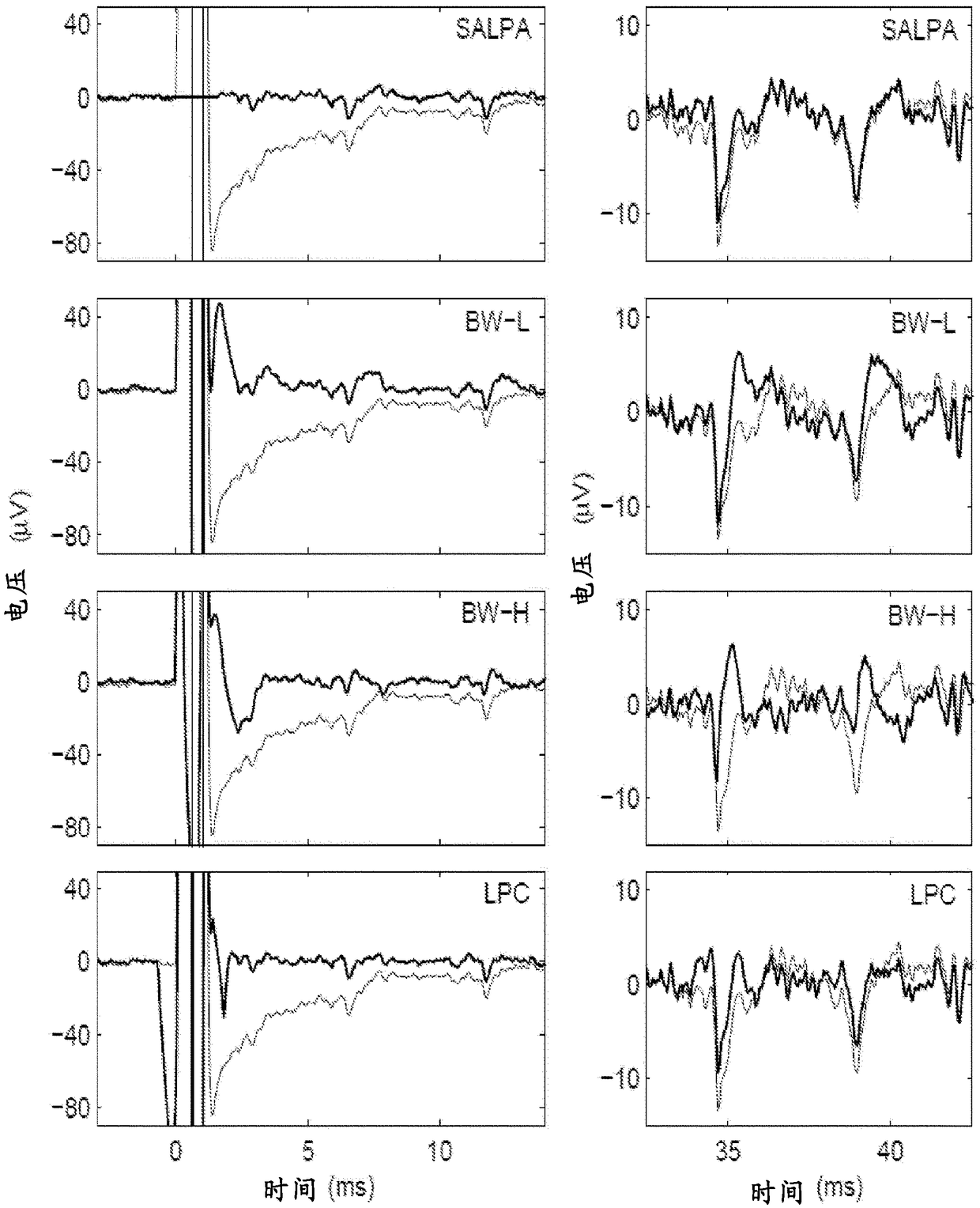 Systems and methods for reducing noise caused by stimulation artifacts in neural signals received by neuro-modulation devices