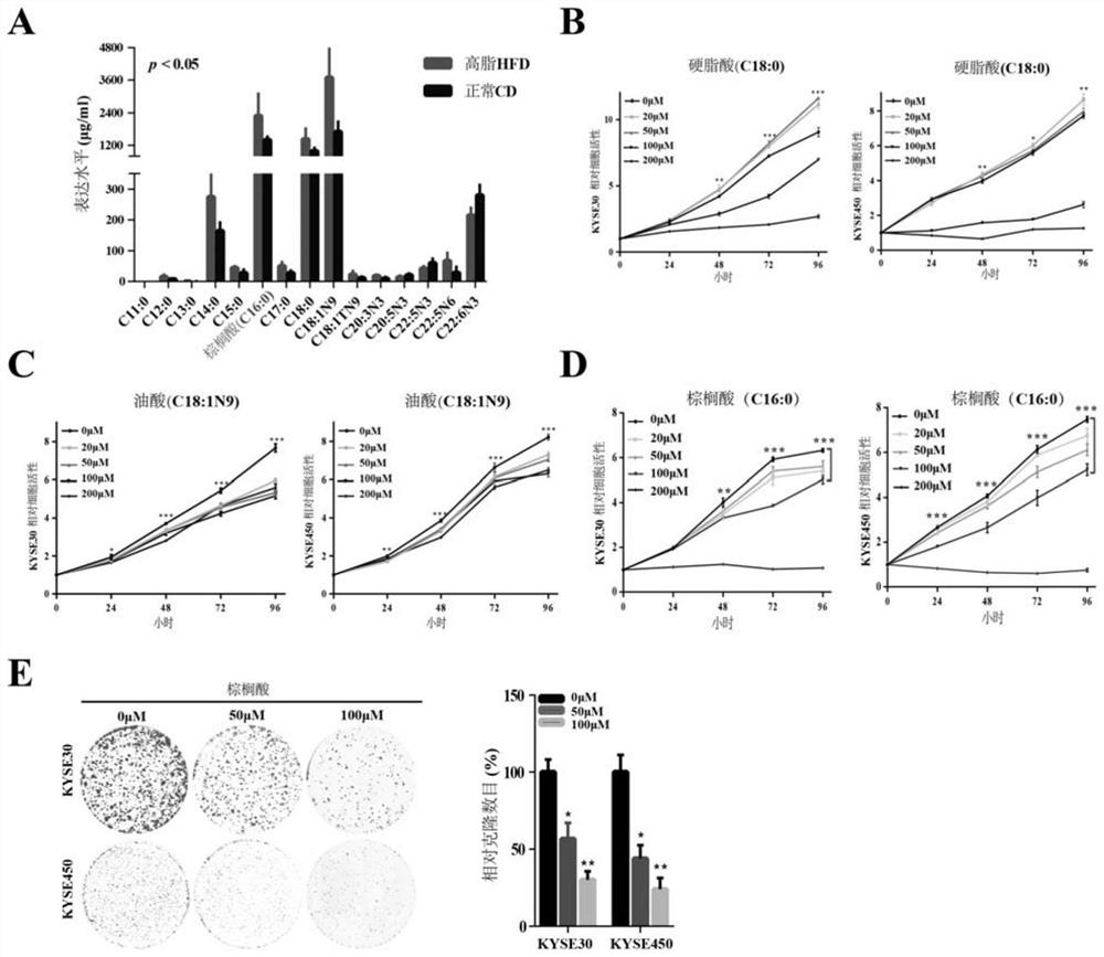 Application of lncRNA SLC25A21-AS1 as marker of esophageal squamous cell carcinoma