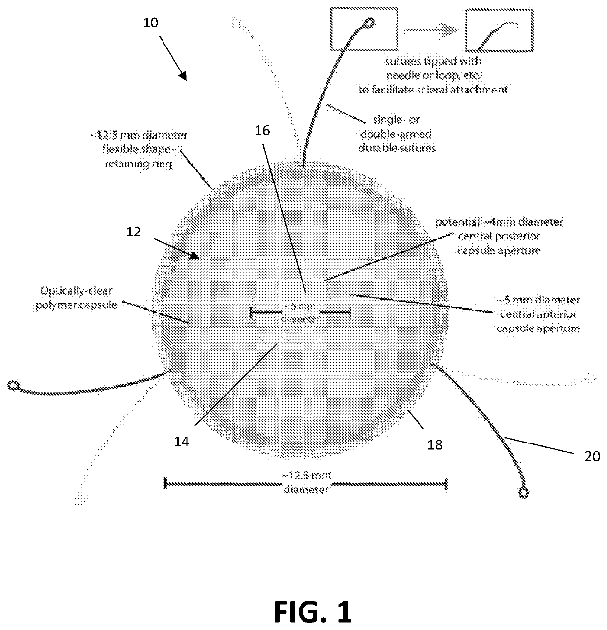 Implantable lens capsule for intraocular lens insertion