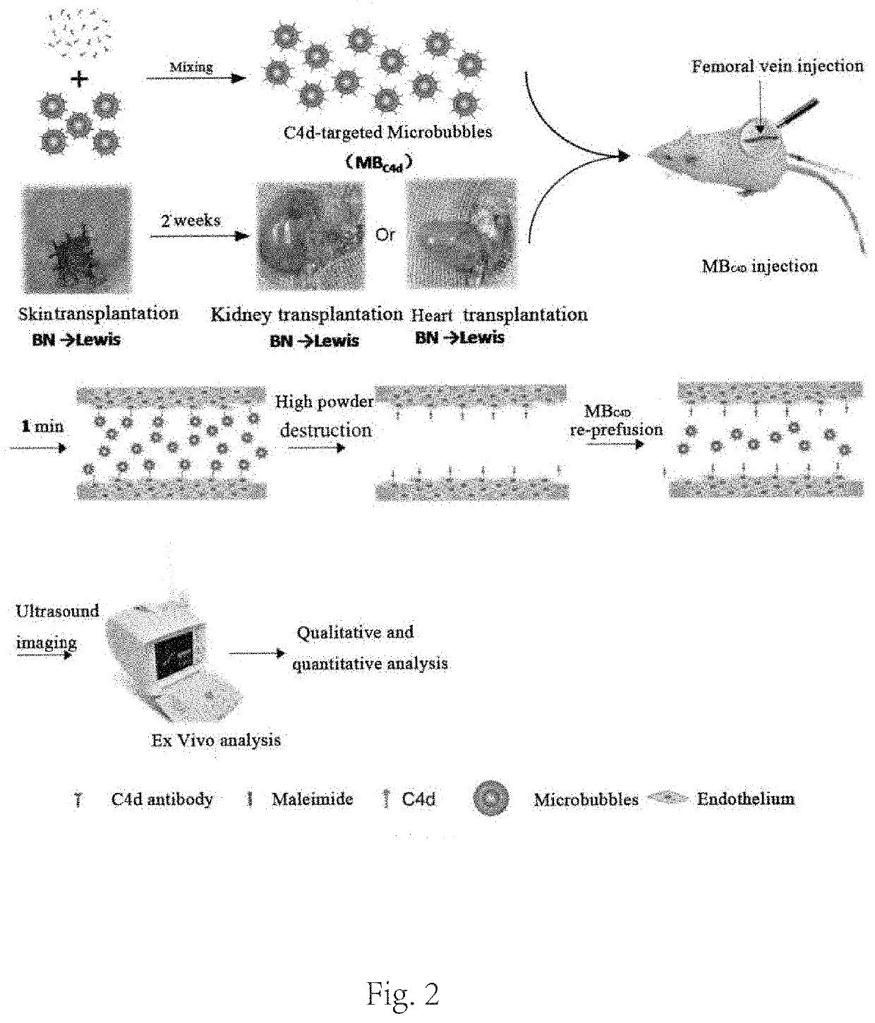 Targeted microbubble, preparation method thereof, and use thereof