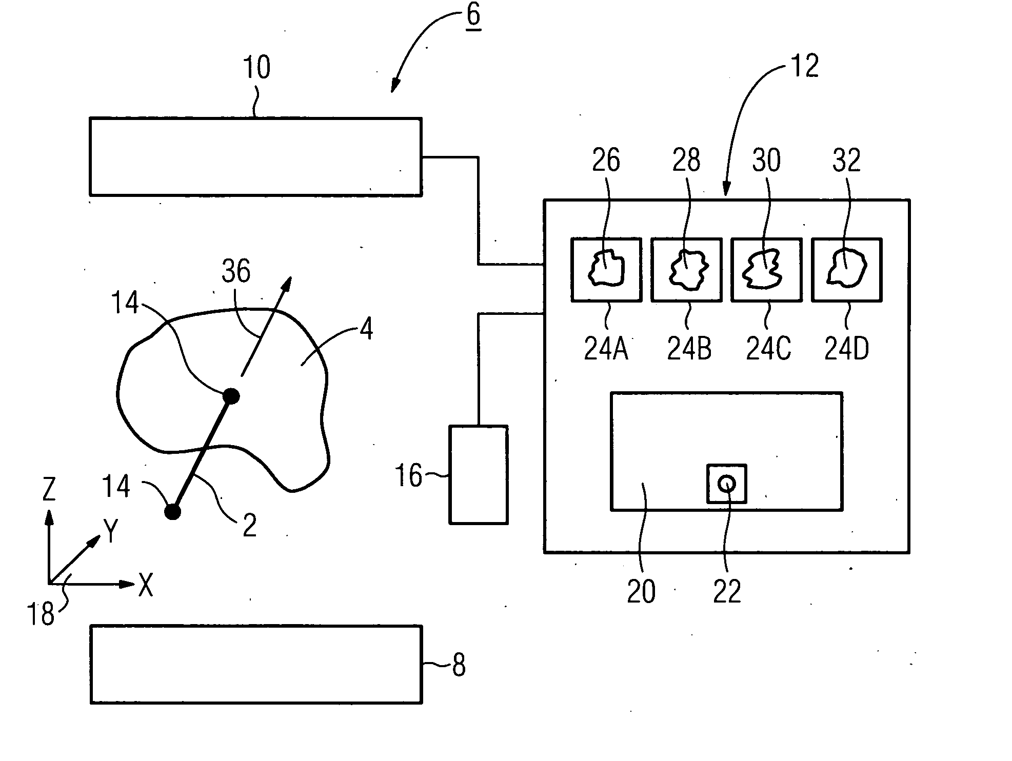 Method for displaying a medical implant in an image and a medical imaging system