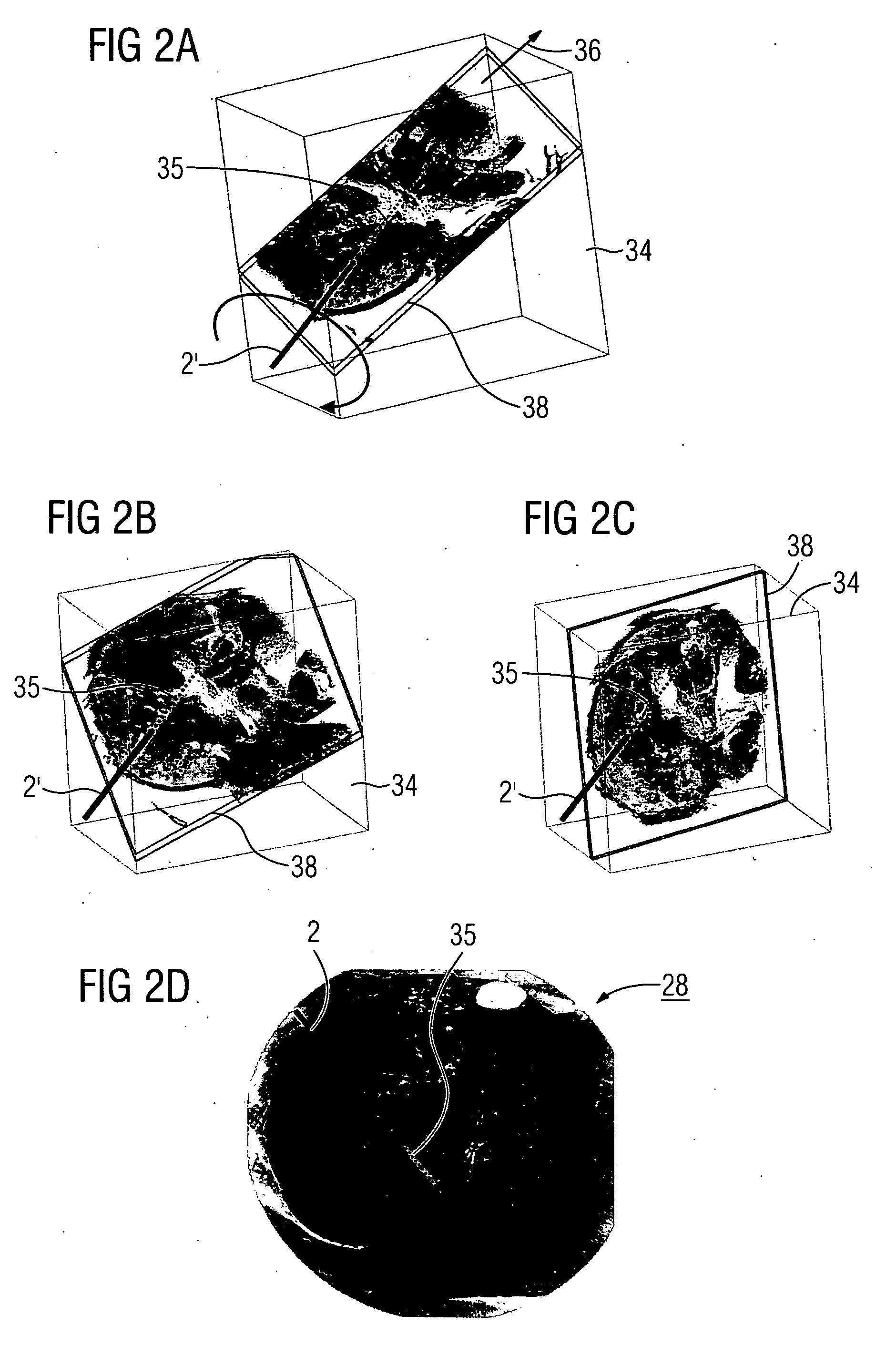 Method for displaying a medical implant in an image and a medical imaging system