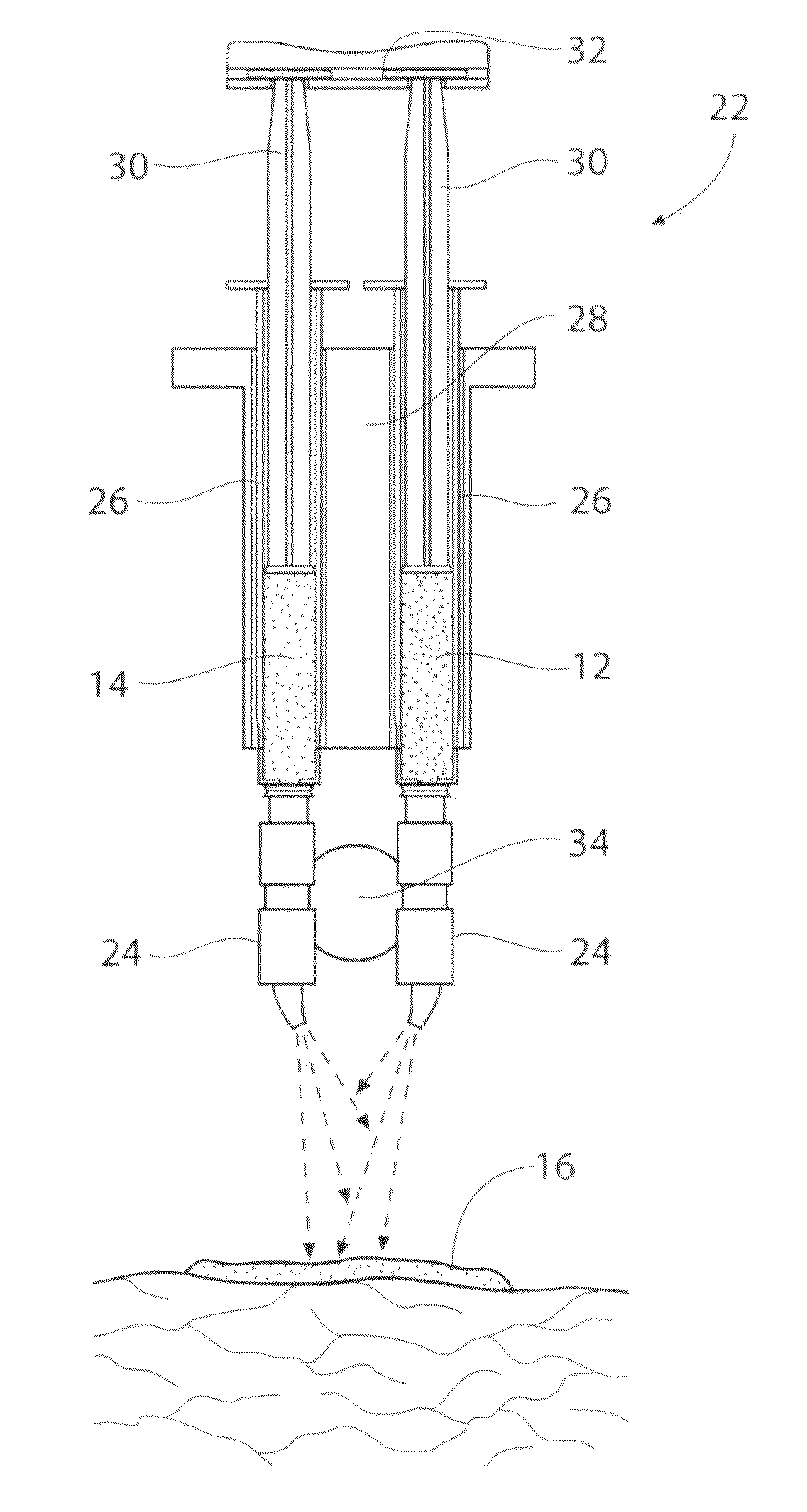 Wound treatment systems, devices, and methods using biocompatible synthetic hydrogel compositions