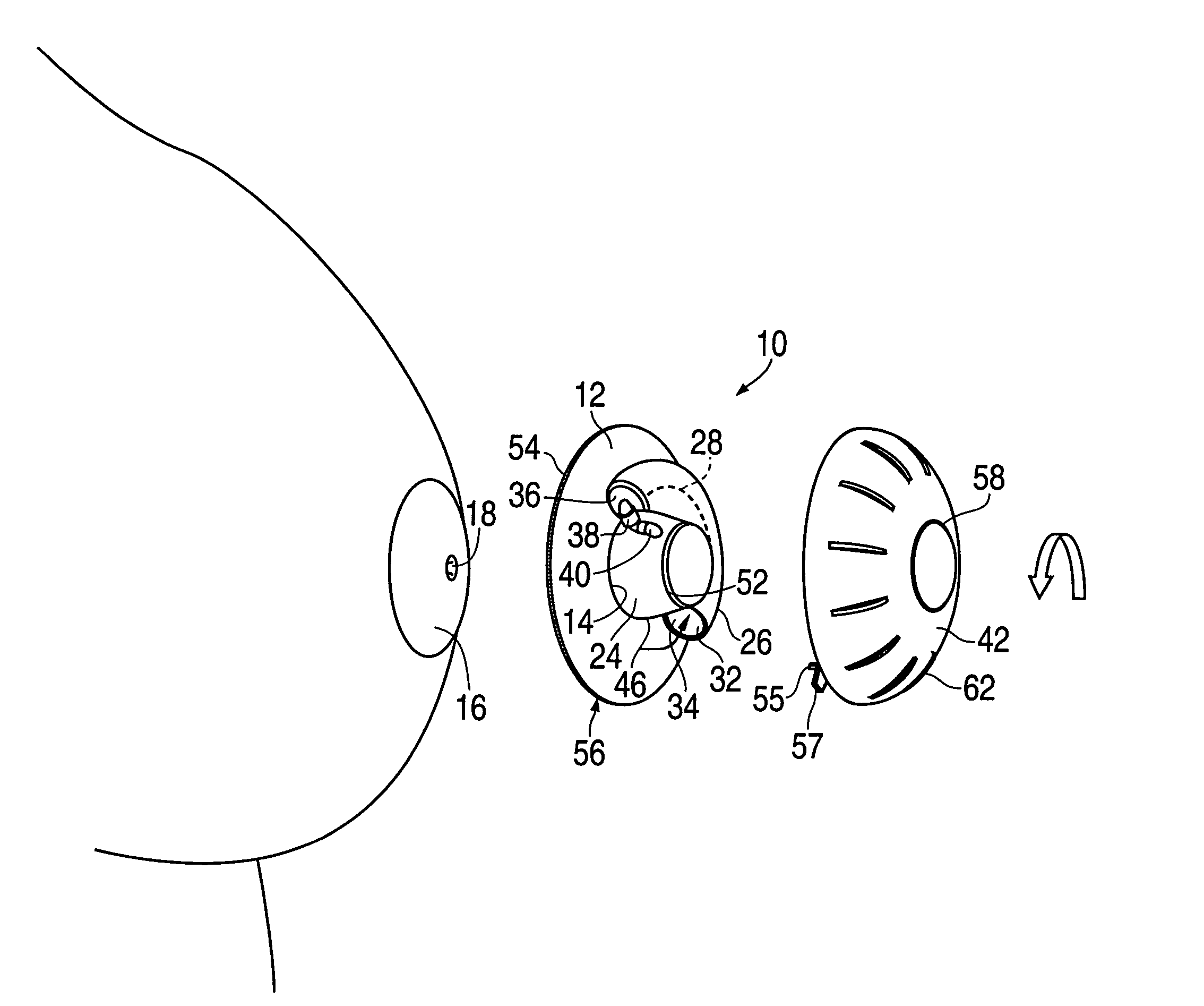 Device for non-surgical correction of congenital inverted nipples and/or collection of nipple aspirate fluid