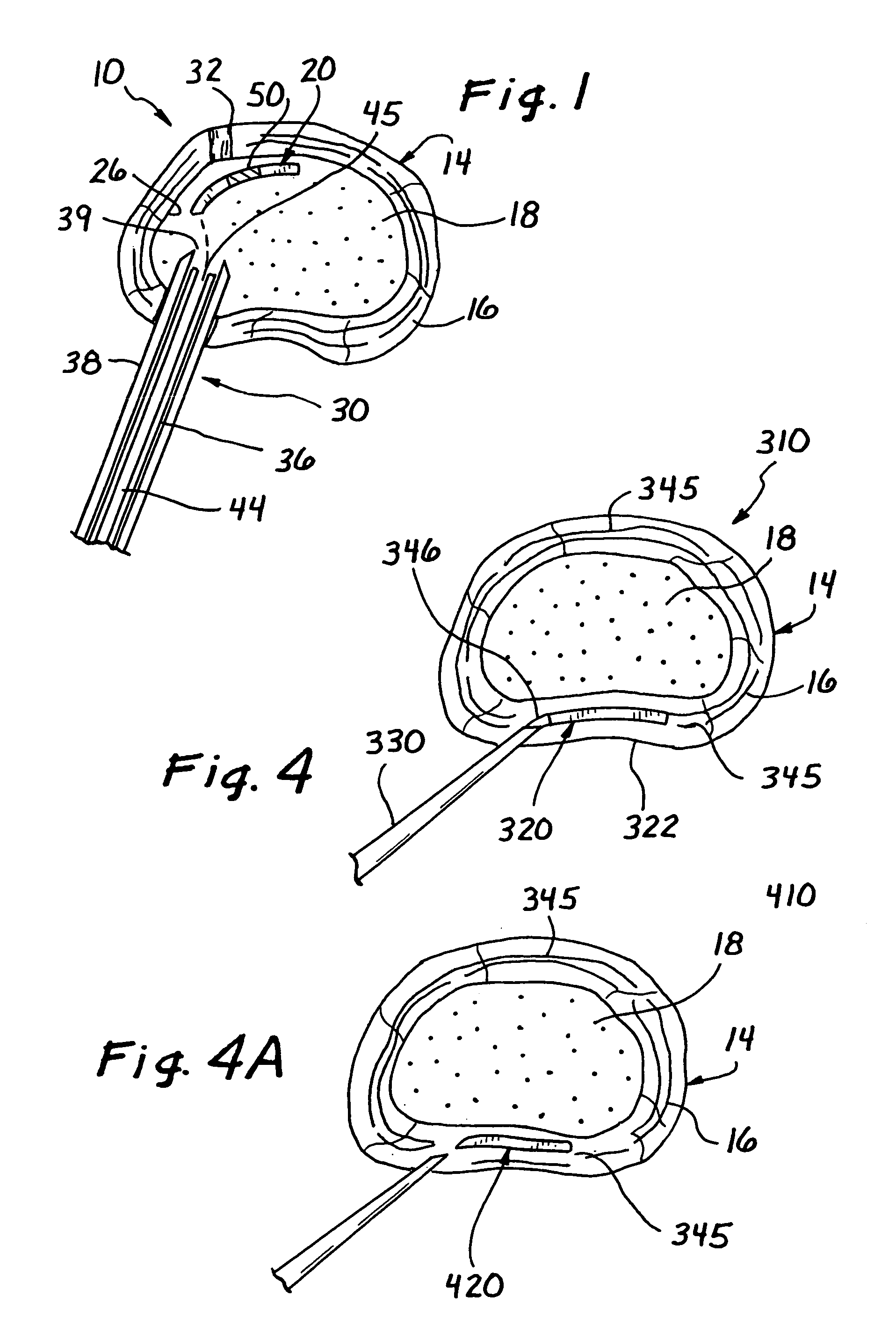 Spinal disc therapy system