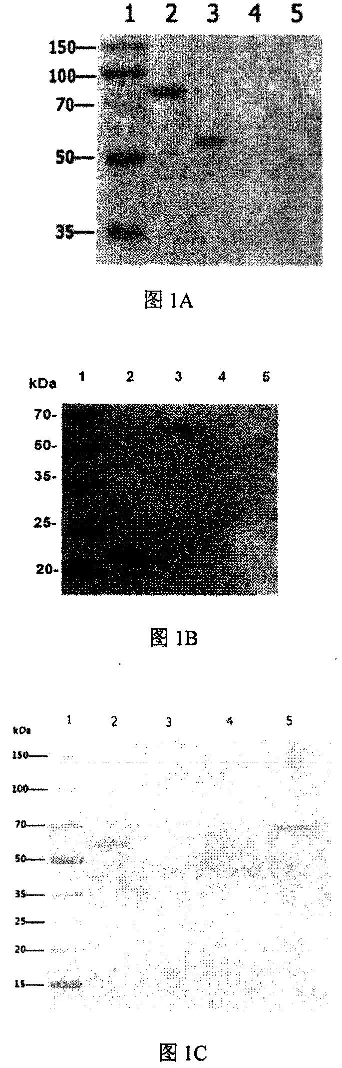 Linear 23 peptide capable of coupling single B cell epitope or hapten to prepare immunomodulating peptide and antibody and application thereof