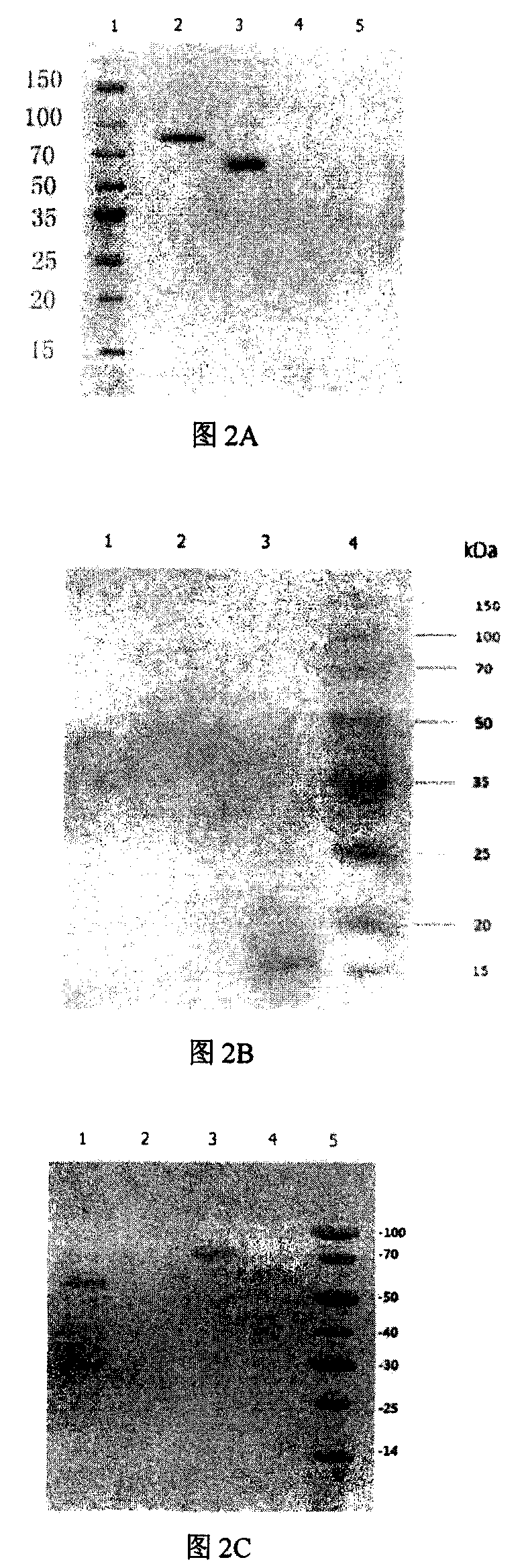 Linear 23 peptide capable of coupling single B cell epitope or hapten to prepare immunomodulating peptide and antibody and application thereof