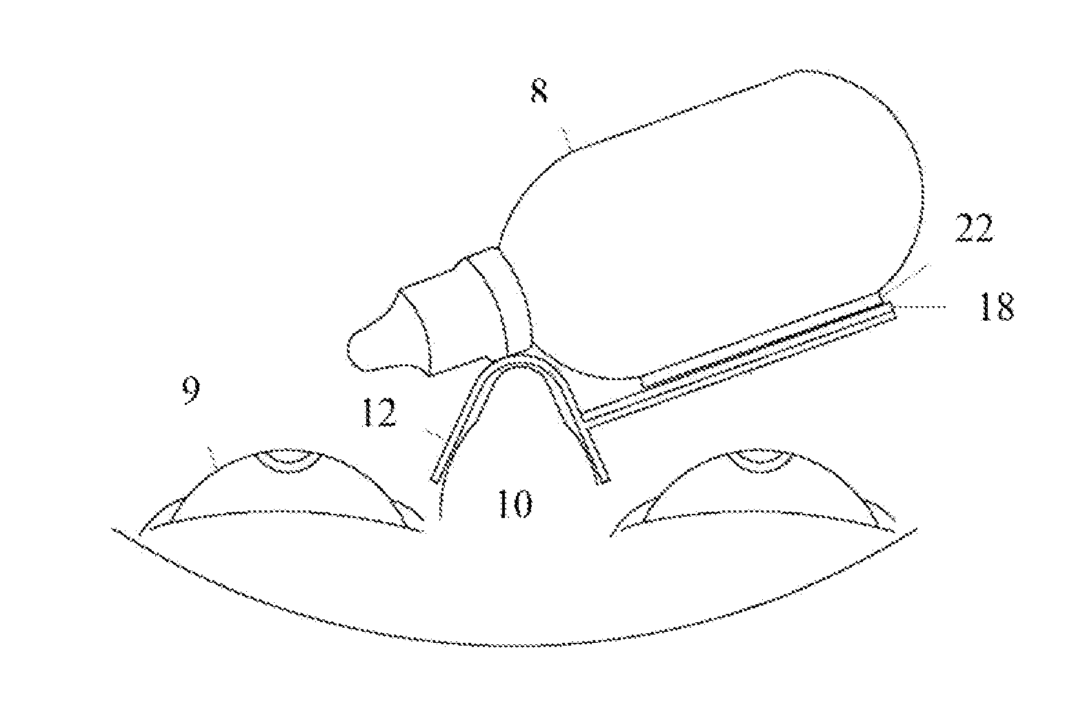 Ophthalmic device to guide and aid the use of an eye drop dispenser