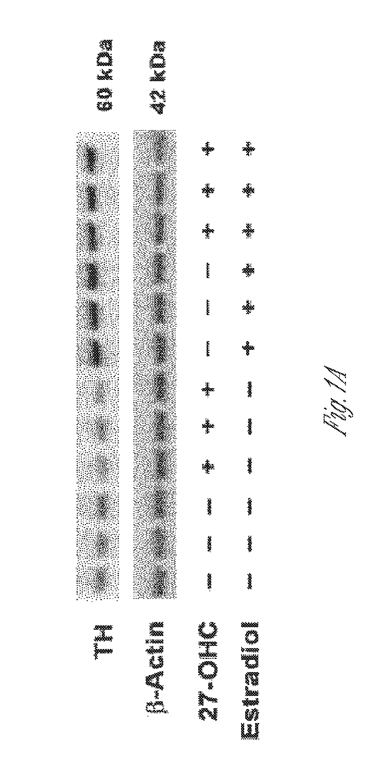 Combination of liver x receptor modulator and estrogen receptor modulator for the treatment of age-related diseases