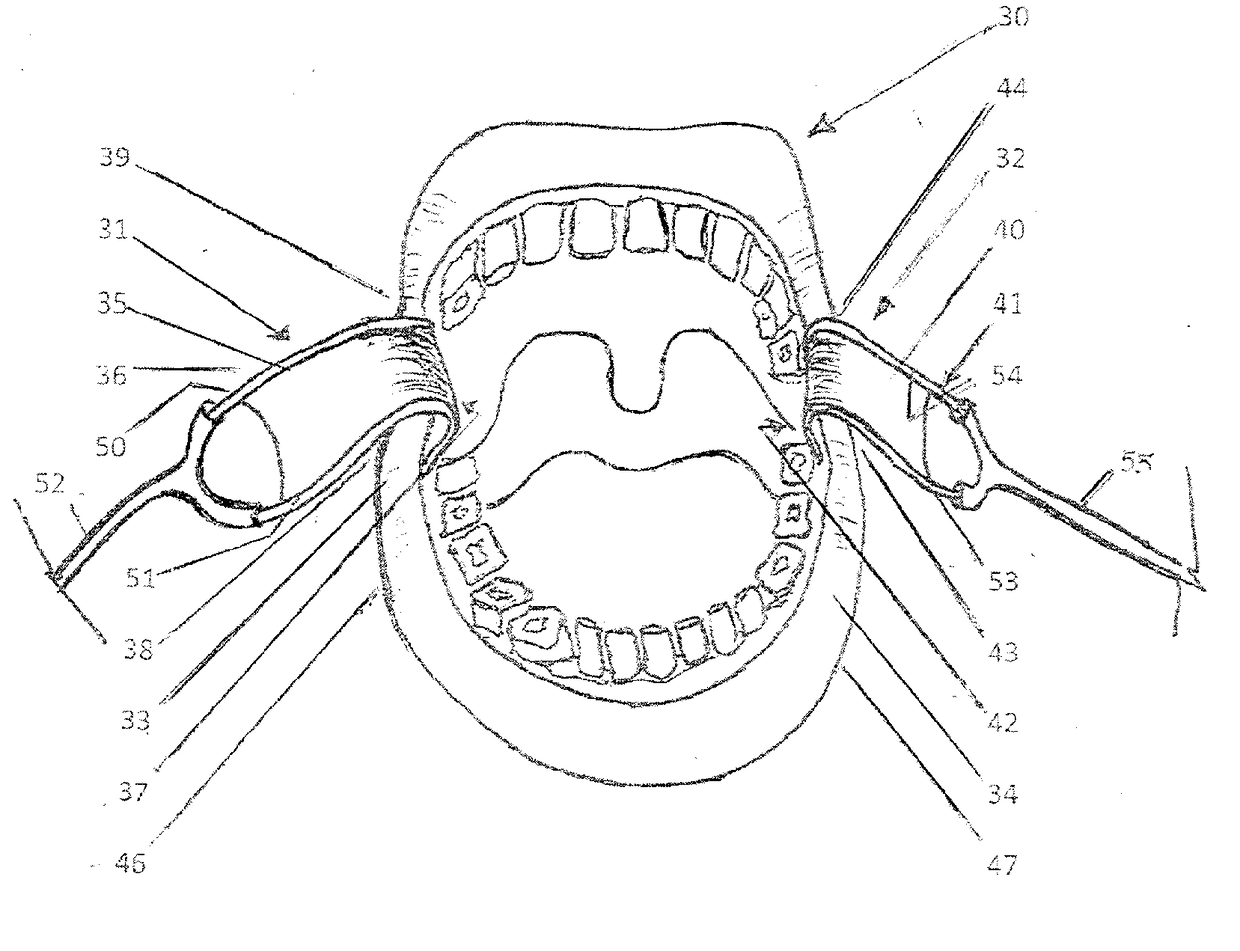 A Protective Device For Use In Oral Surgical Procedure