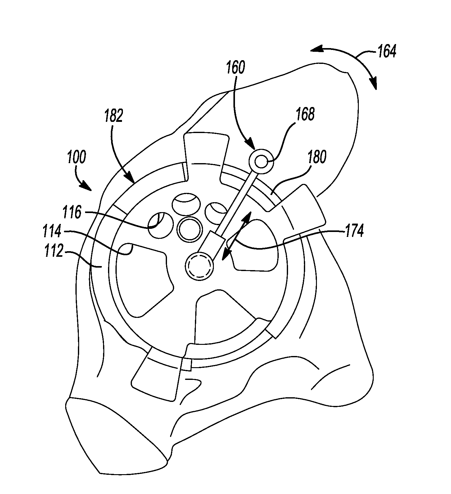 Universal Acetabular Guide And Associated Hardware