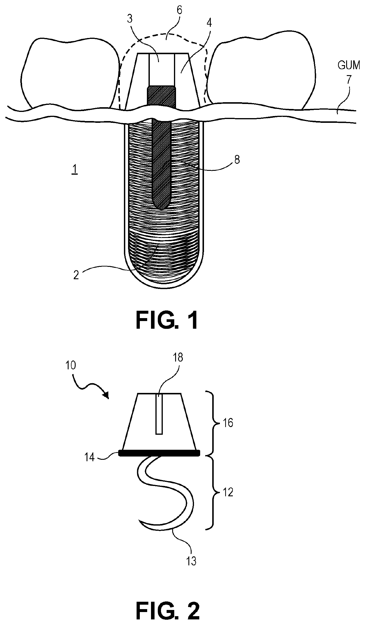 Apparatus for dental prosthetic procedure