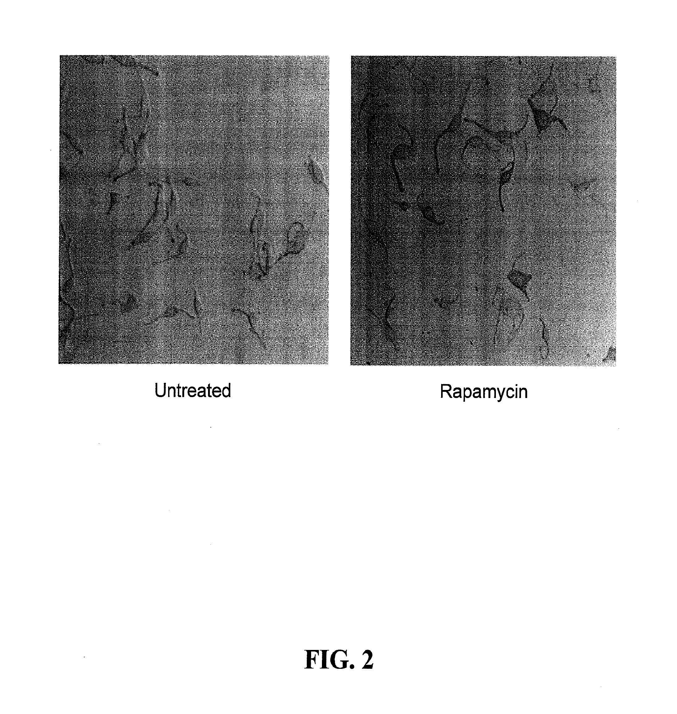Compositions and methods for treatment of vitiligo