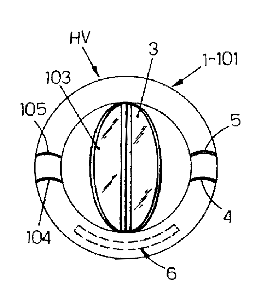 Heart valve prosthesis with integrated electronic circuit for measuring intravalvular electrical impedance, and system for monitoring functionality of the prosthesis