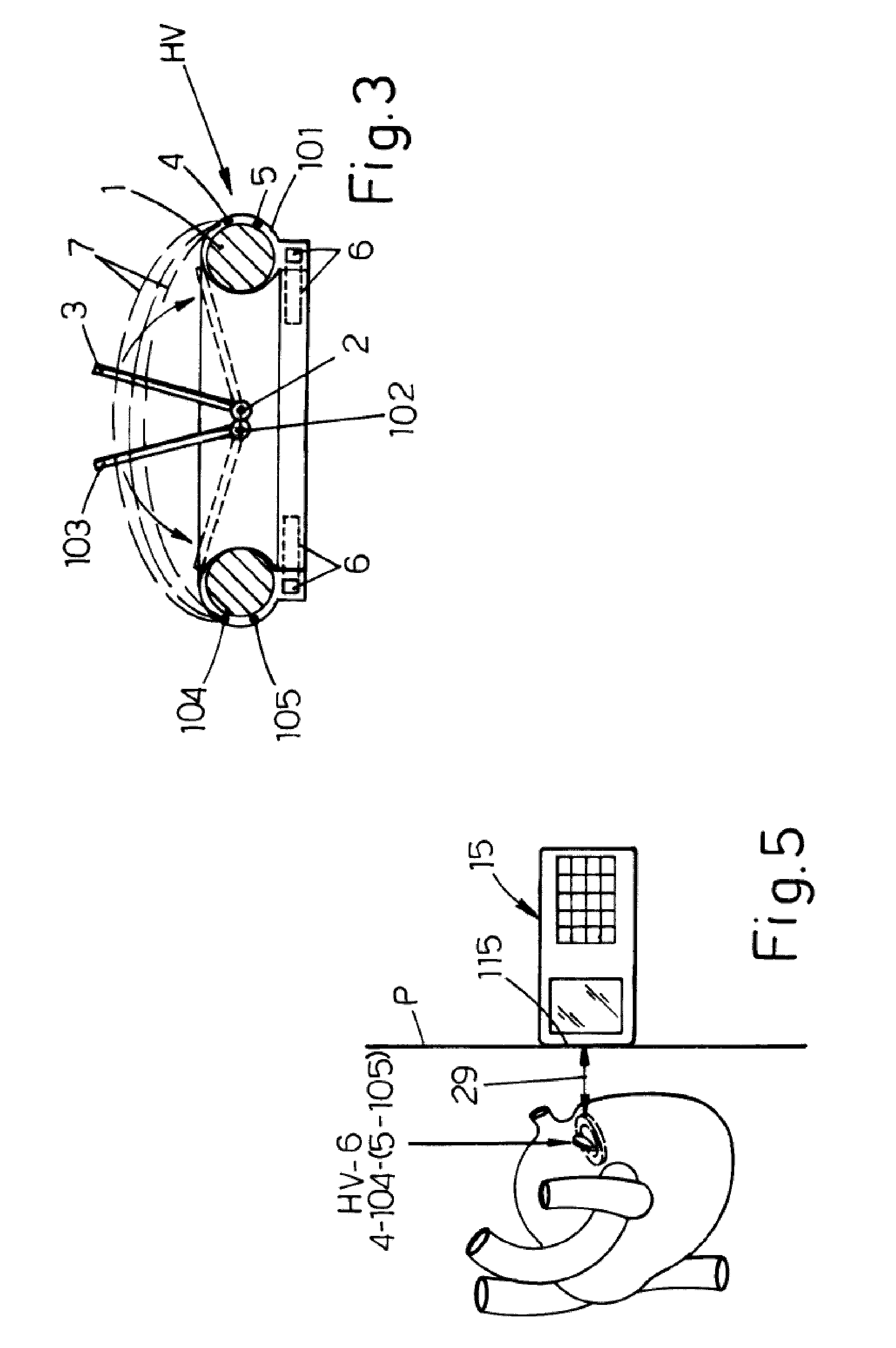 Heart valve prosthesis with integrated electronic circuit for measuring intravalvular electrical impedance, and system for monitoring functionality of the prosthesis