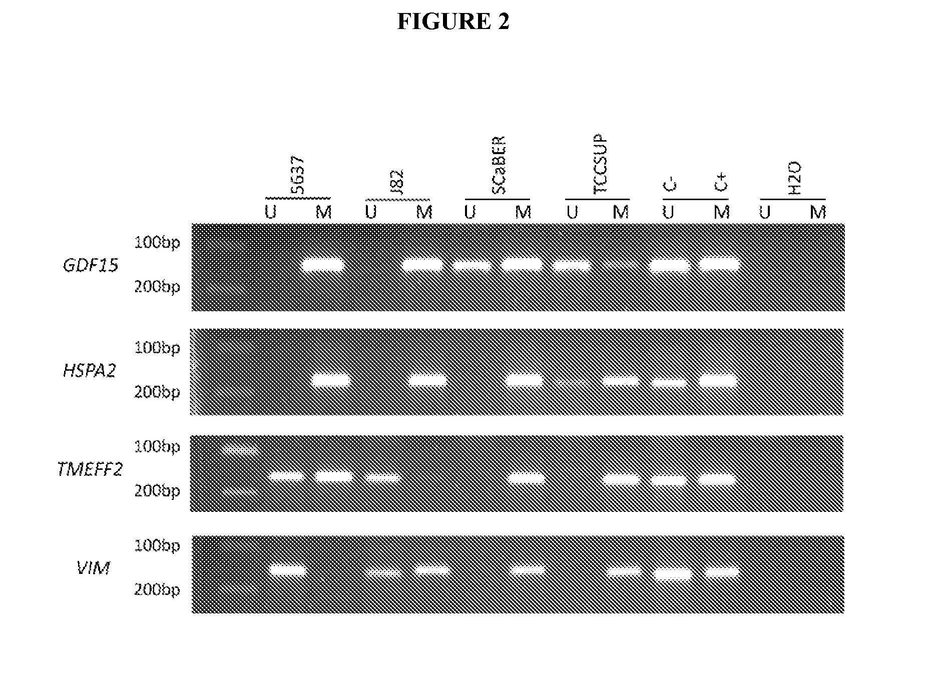 Methods and biomarkers for detection of bladder cancer