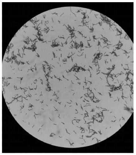 Lactobacillus acidophilus LA-10A capable of inhibiting helicobacter pylori and application thereof