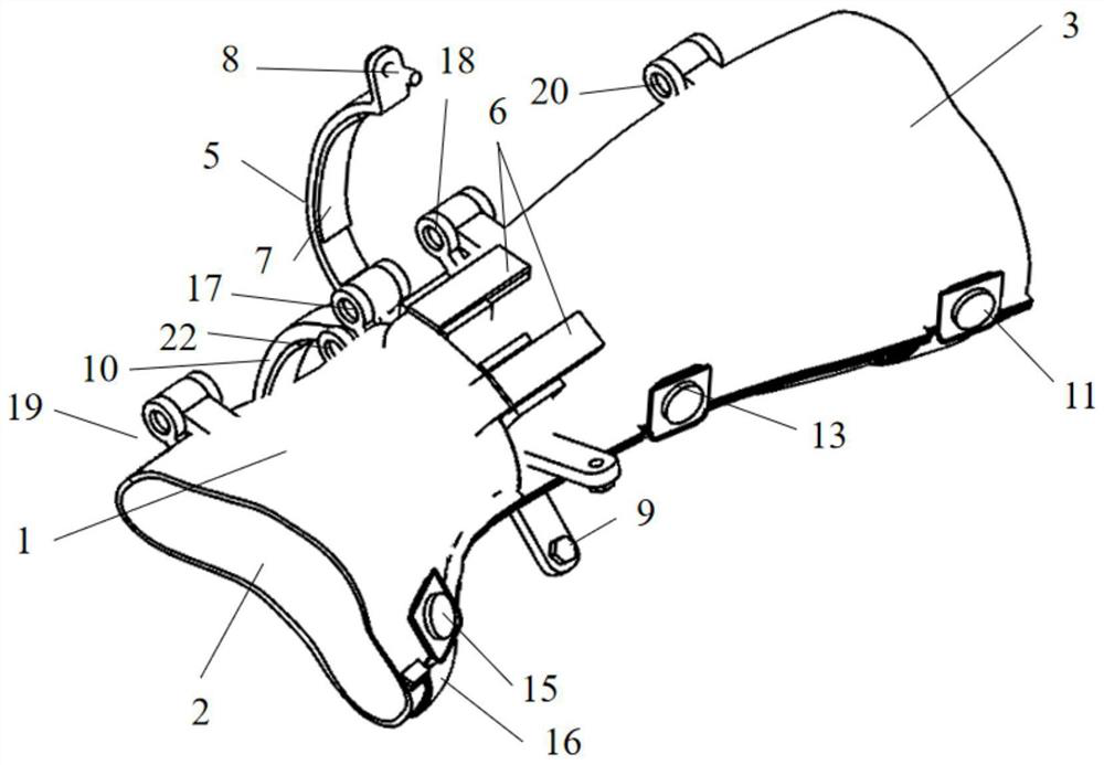 A kind of traction type personalized orthopedic medical splint and using method