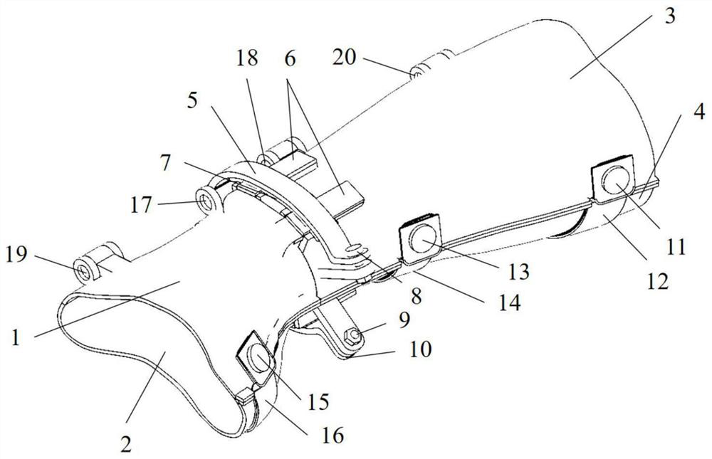 A kind of traction type personalized orthopedic medical splint and using method