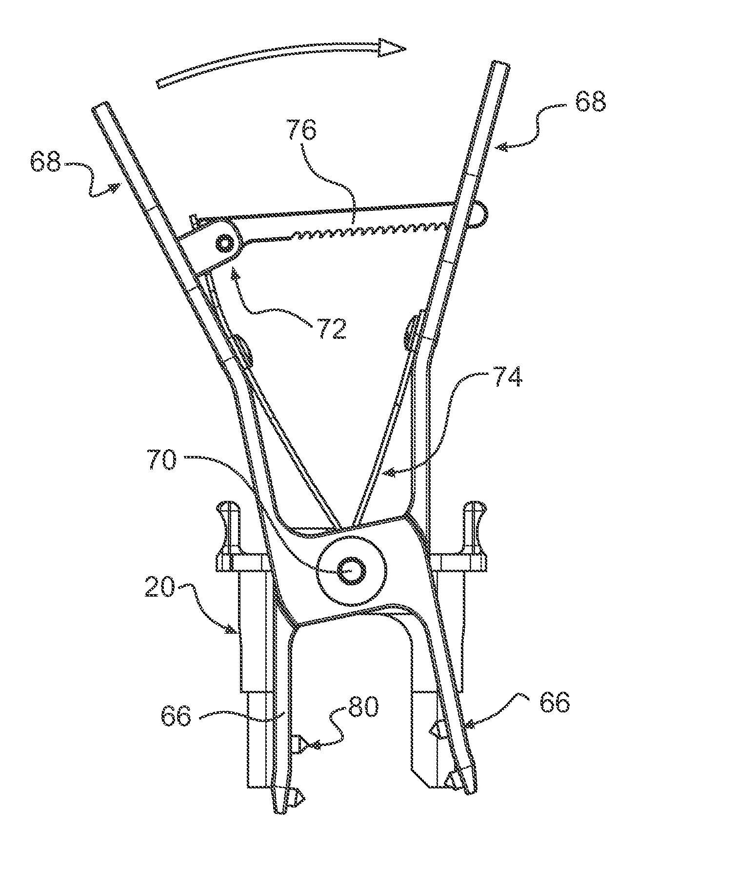Method and system for performing interspinous space preparation for receiving an implant