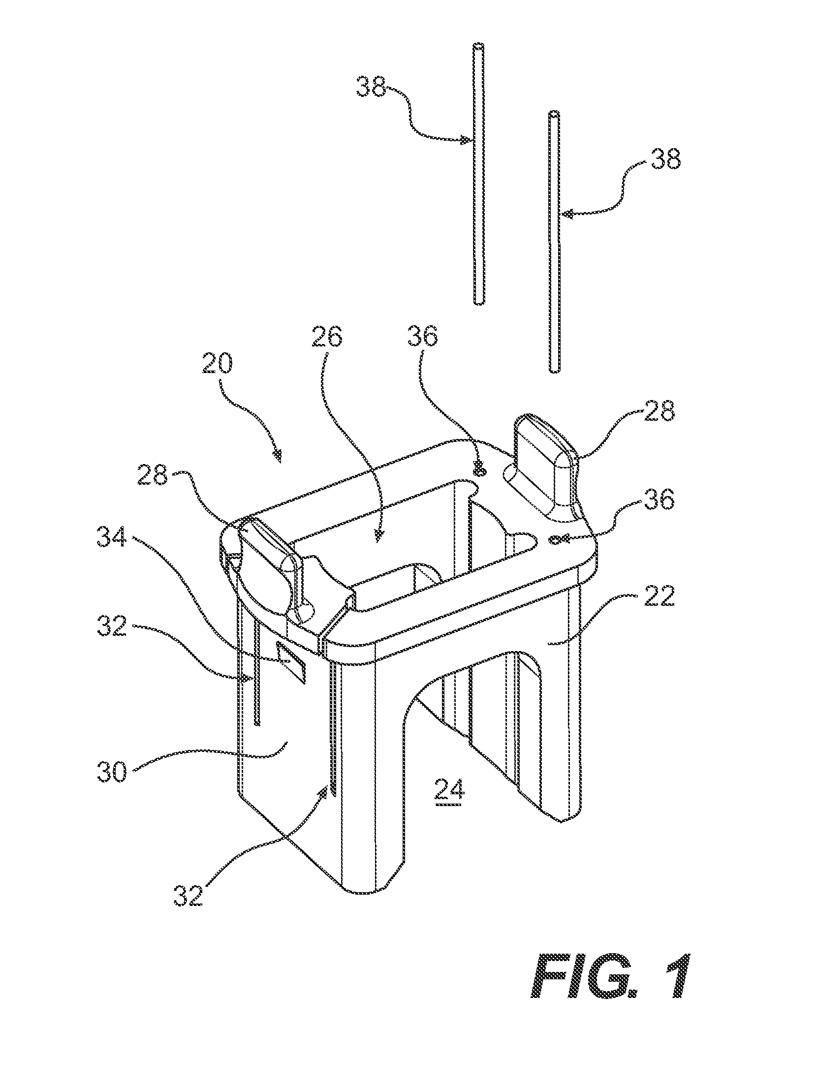 Method and system for performing interspinous space preparation for receiving an implant