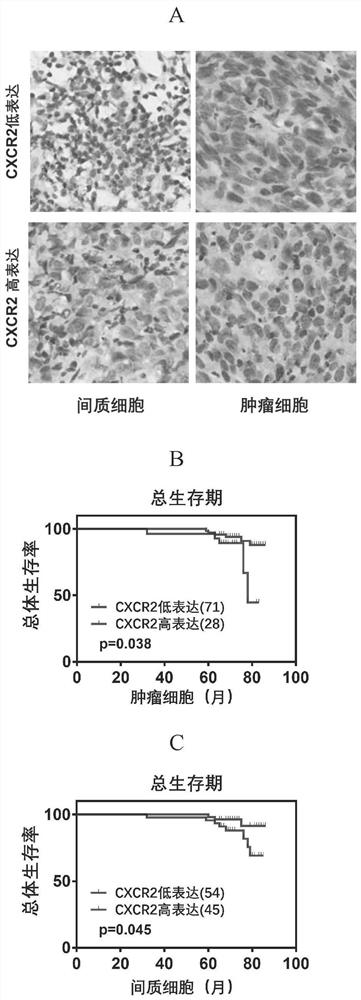 Application of CXCR2 inhibitor in preparation of medicine for treating nasopharynx cancer