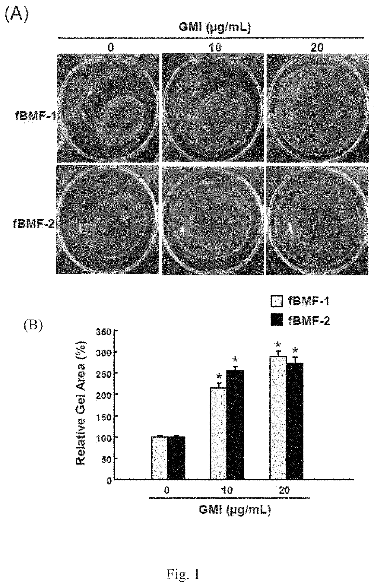 Use of immunomodulatory protein from <i>Ganoderma </i>in inhibiting fibrosis
