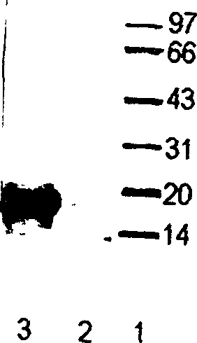 Killer cell antibiosis polypeptide activated by lymphokine and its application