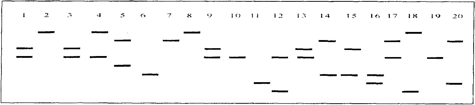 Method for detecting micro-satellite marker LJ_liu of Lateolabrax japonicus