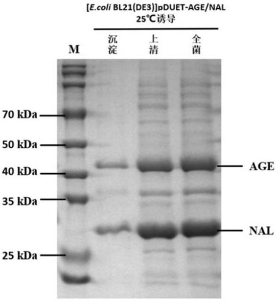 Enzyme co-expression system and its application in the synthesis of sialic acid