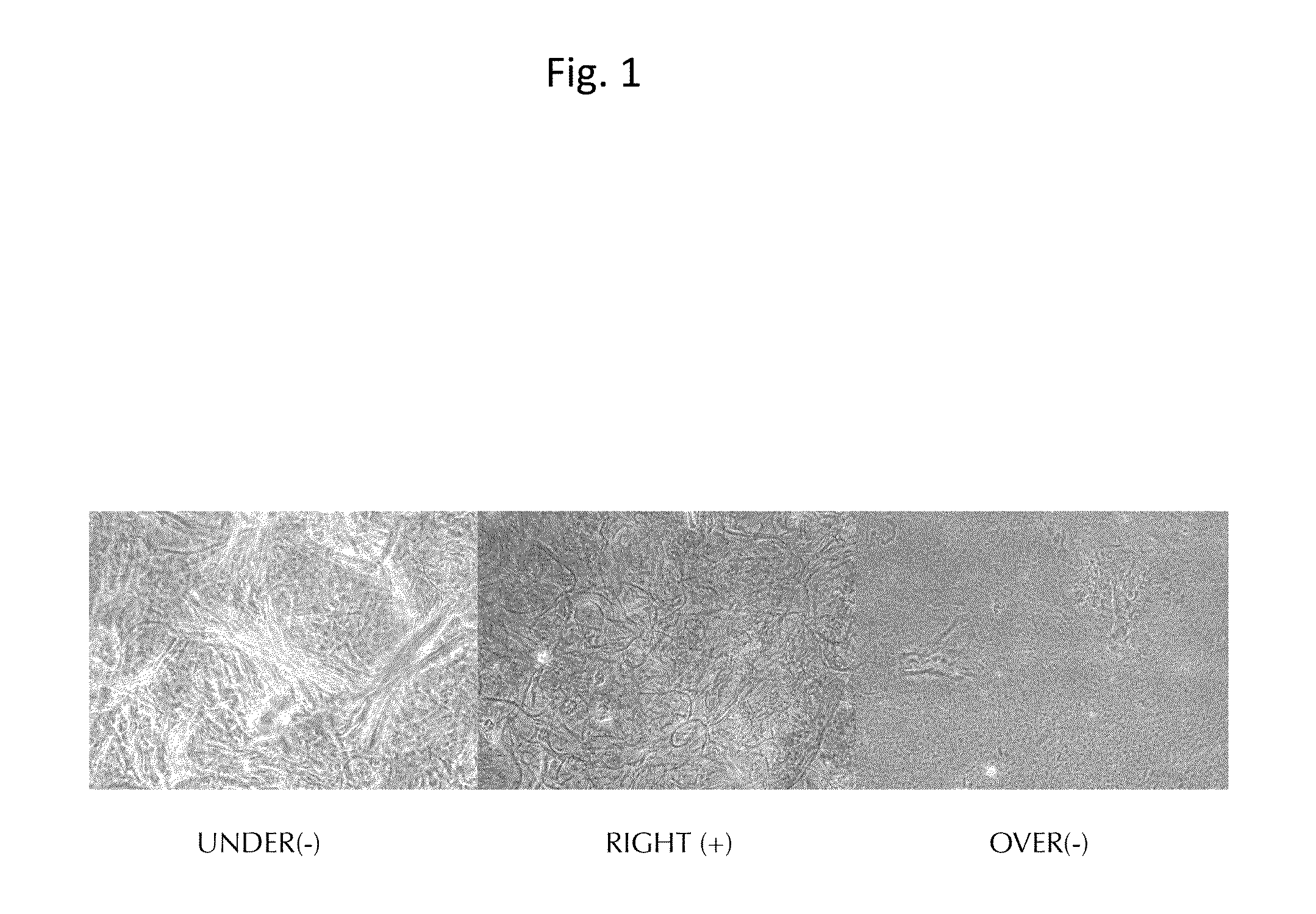 Injectable composition for in-situ repair and regeneration of an injured ligament or tendon and methods of use