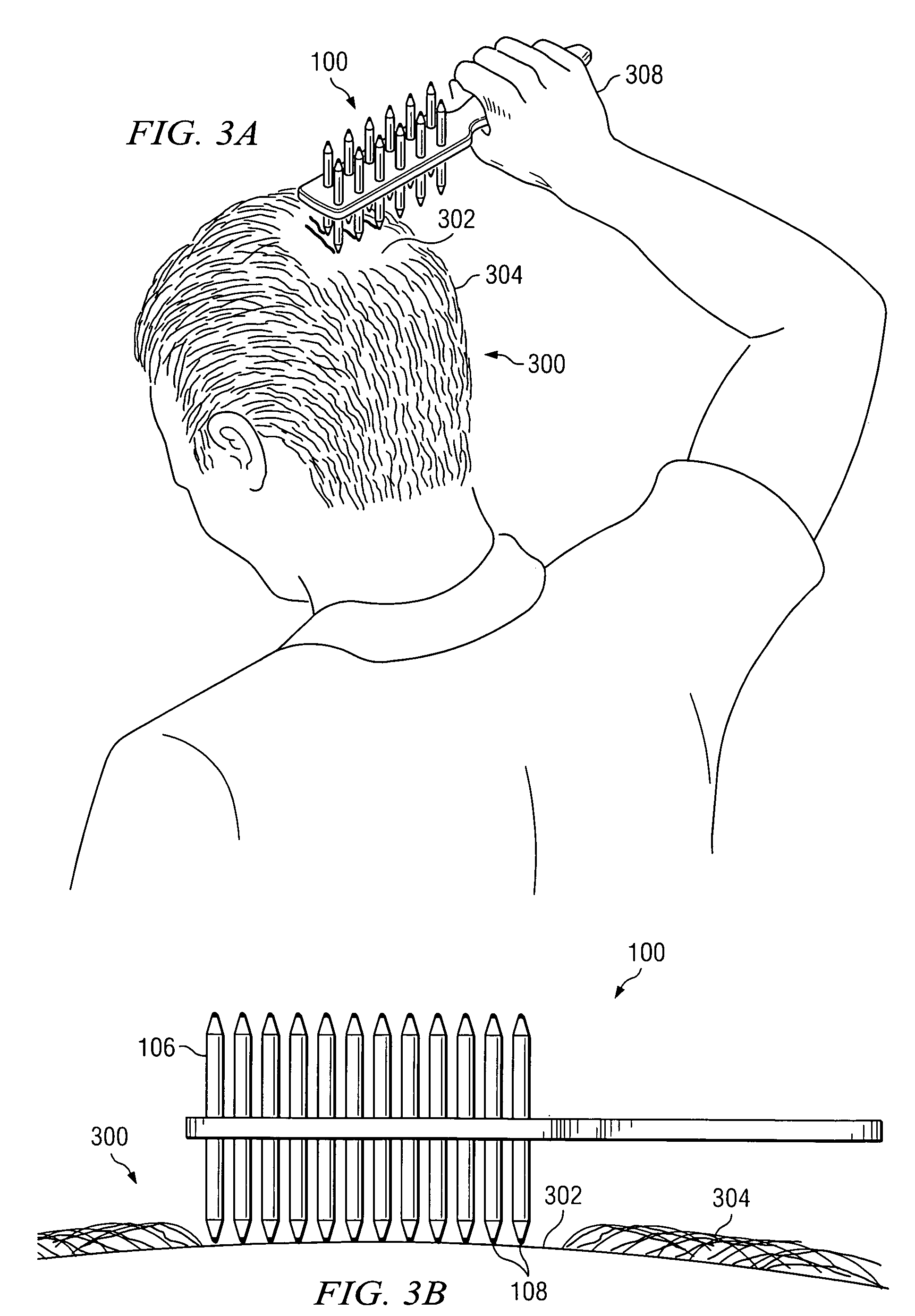 Apparatus and method for coloring skin