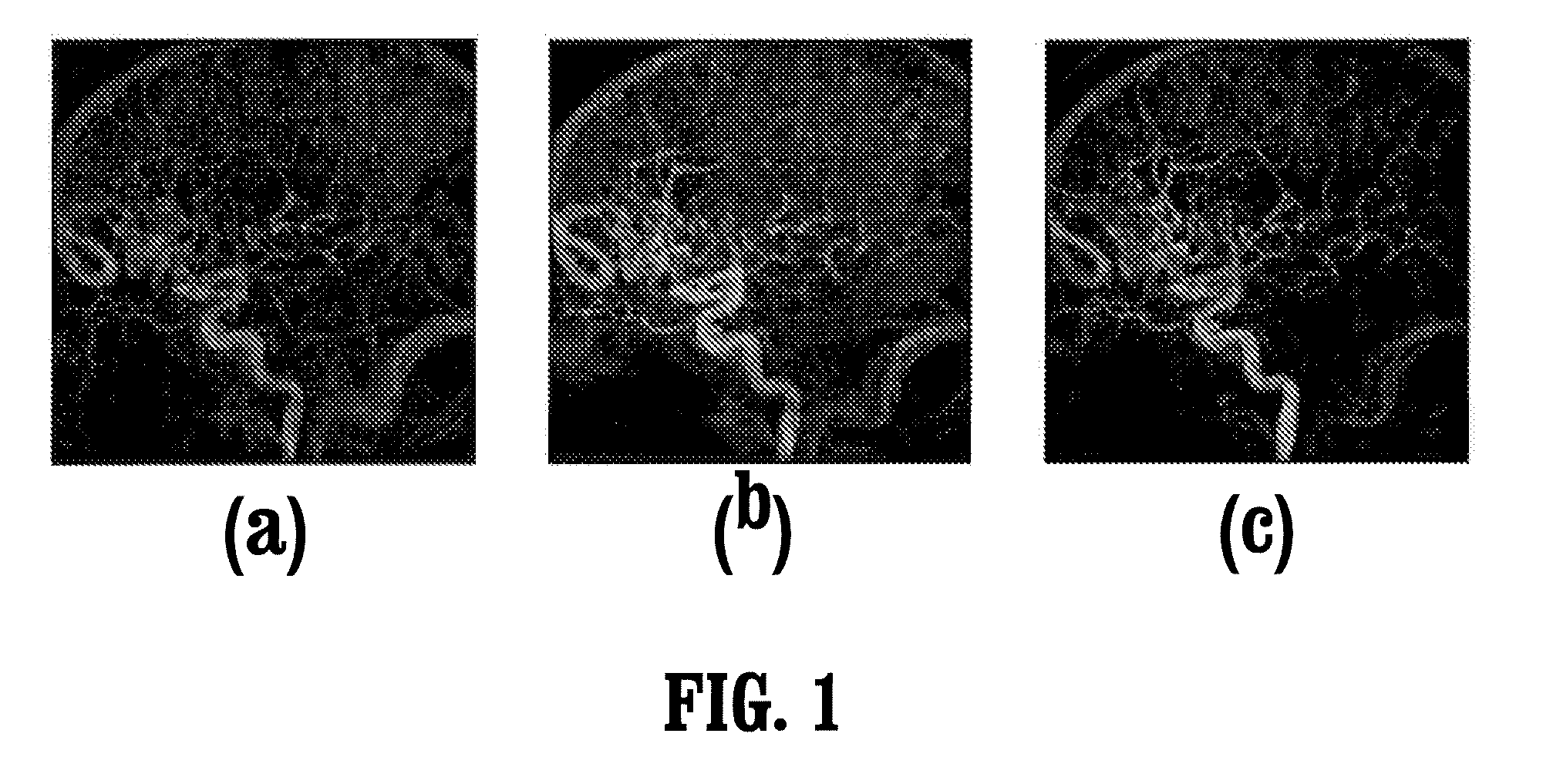 System and method for two-dimensional visualization of temporal phenomena and three dimensional vessel reconstruction