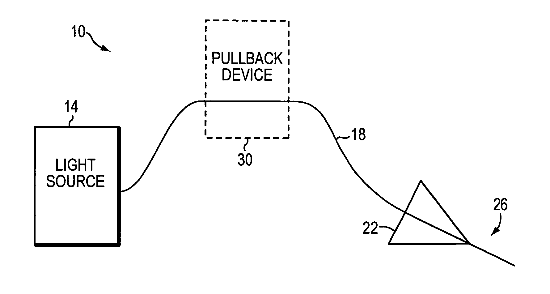 Endovascular treatment of a blood vessel using a light source