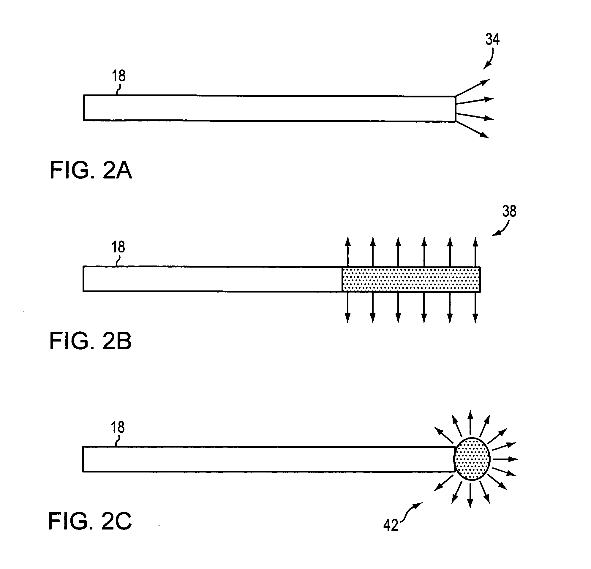 Endovascular treatment of a blood vessel using a light source