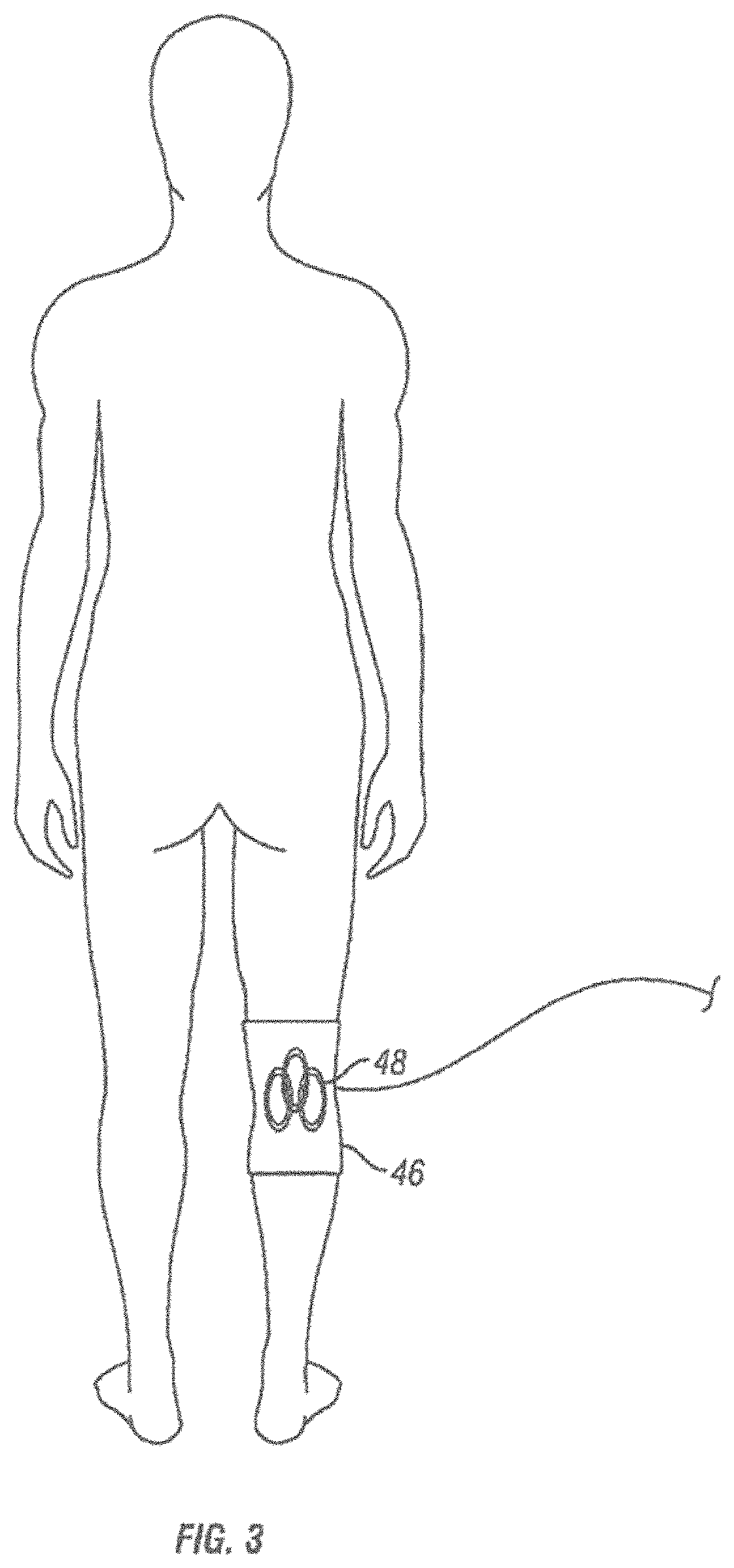 Method and apparatus for transdermal stimulation over the palmar and plantar surfaces