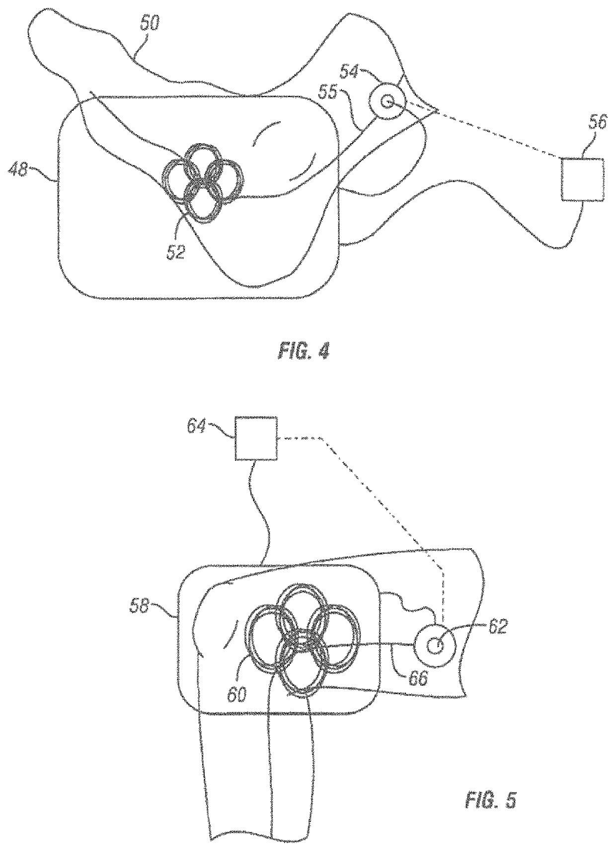 Method and apparatus for transdermal stimulation over the palmar and plantar surfaces