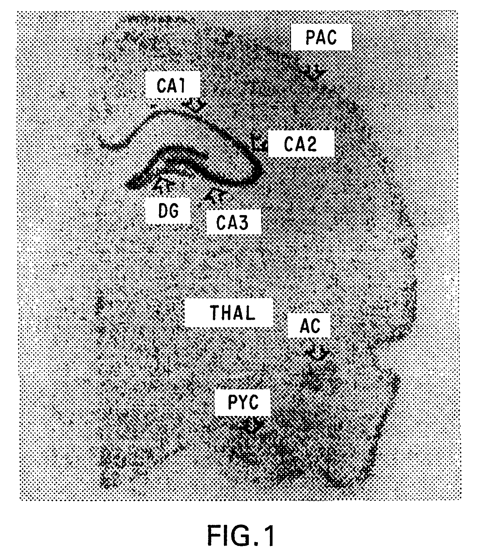 Transgenic mouse expressing the human cyclooxygenase-2 gene and neuronal cell cultures derived therefrom