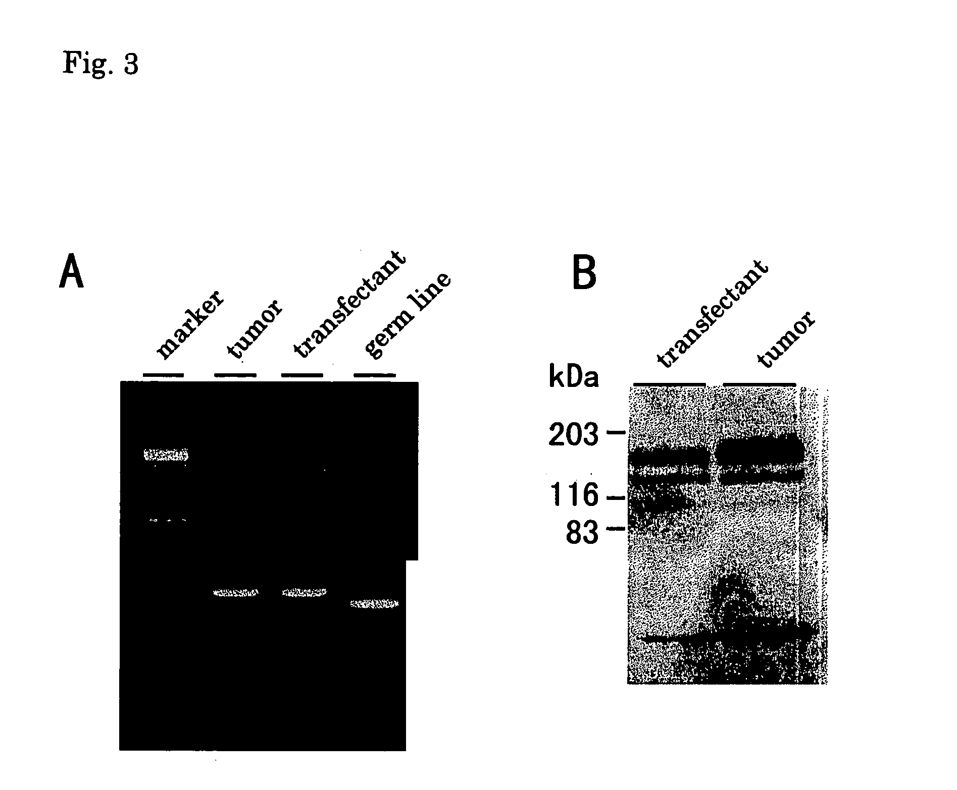Method and screening candidate compounds for drug against tumor