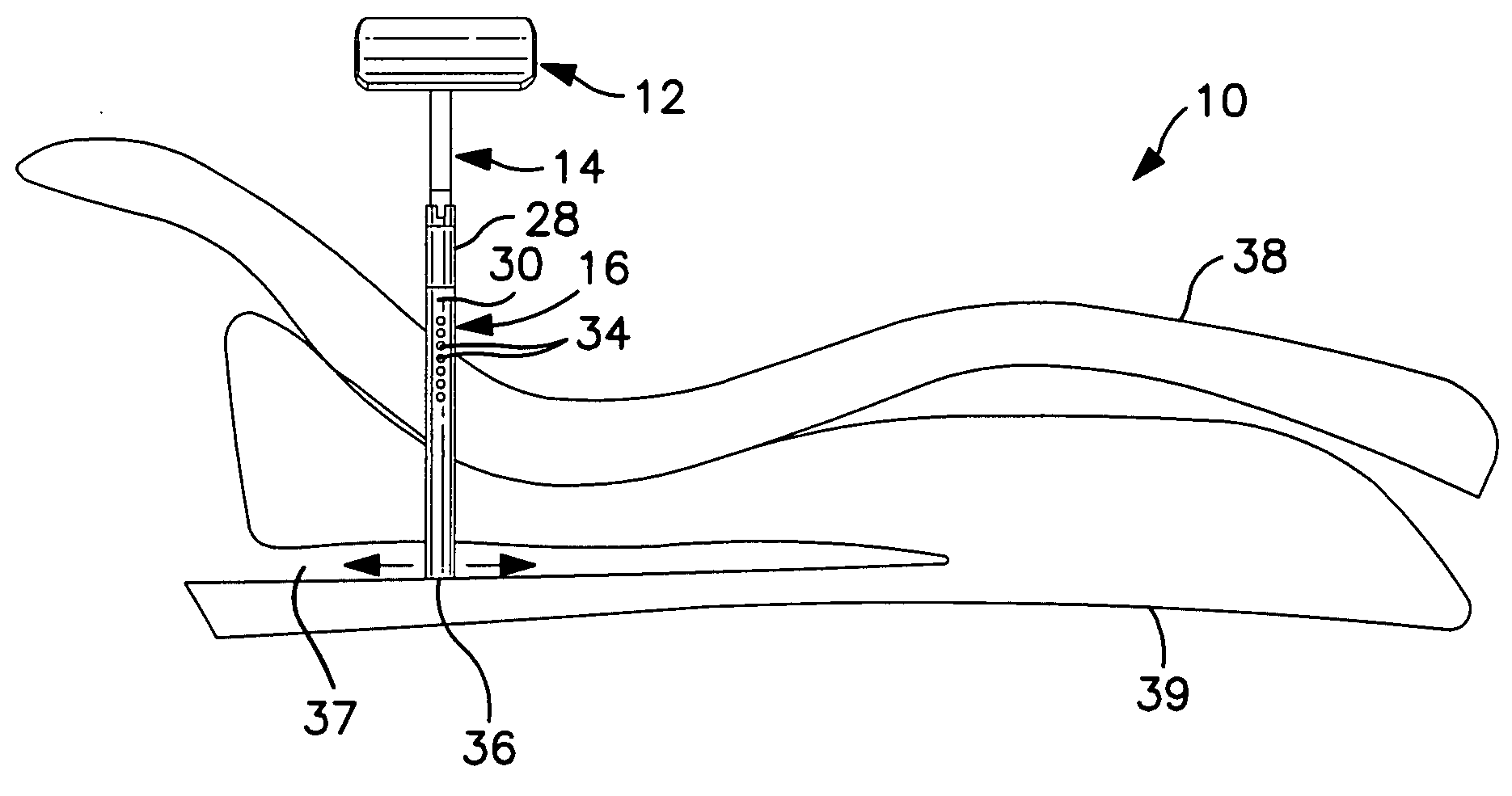 Anterior support device