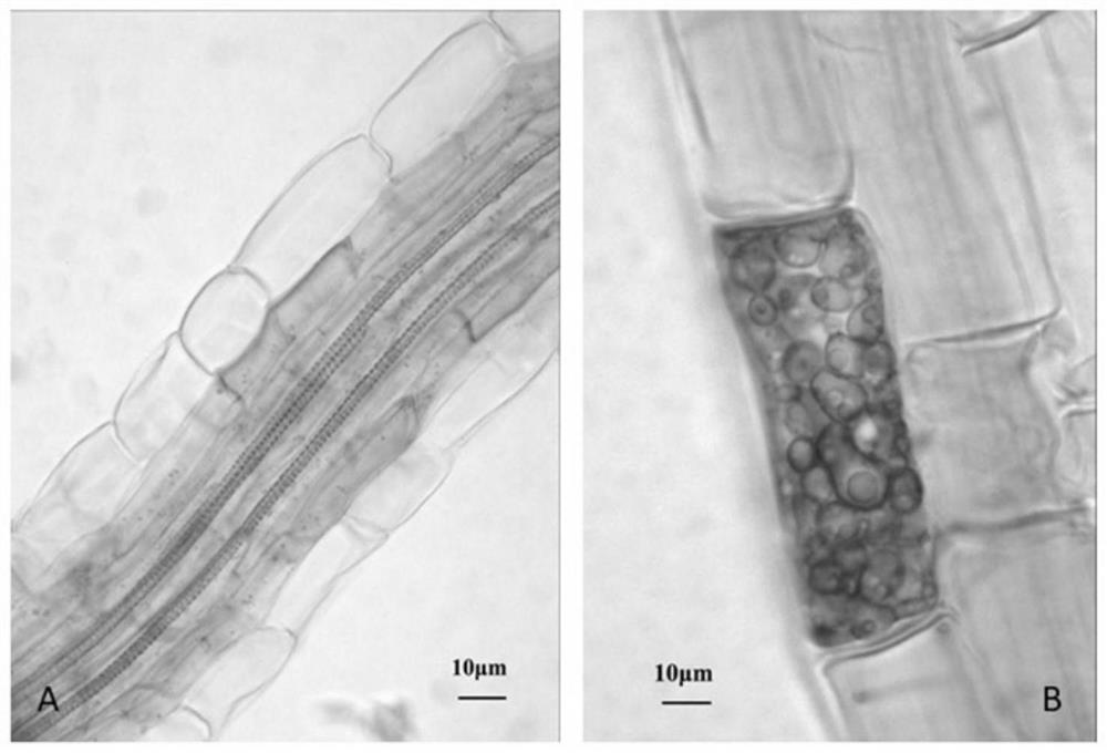 A kind of dark septate endophyte fungus on blueberry roots and application thereof