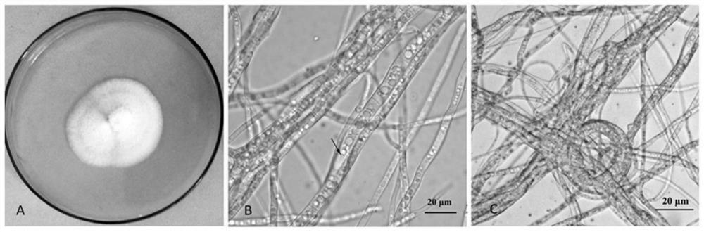 A kind of dark septate endophyte fungus on blueberry roots and application thereof