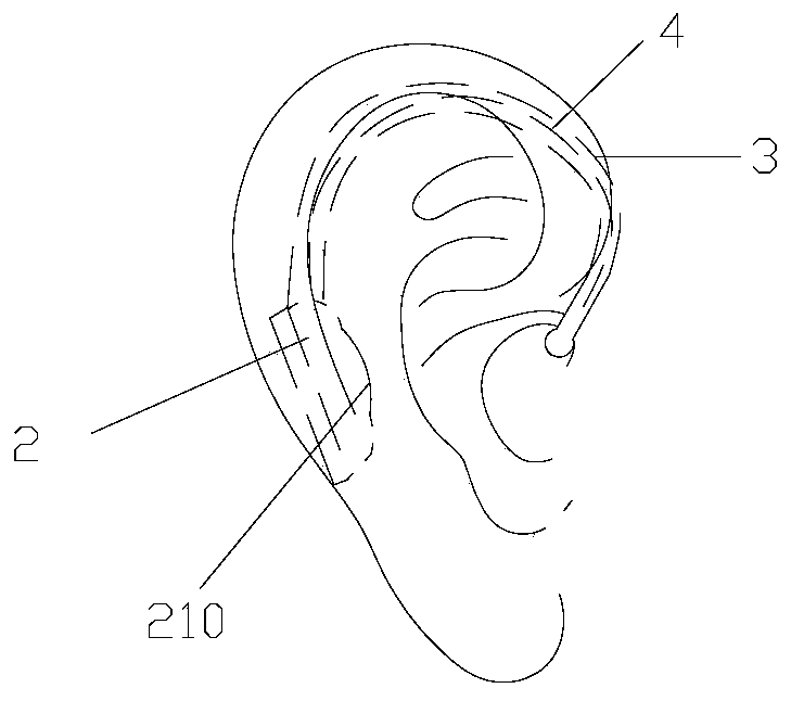 Ear back type bone conduction hearing aid device