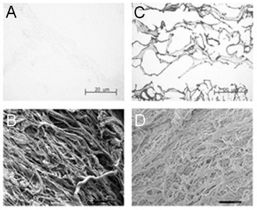 Cellularization biological liver stent with anticoagulation property and preparation method of cellularization biological liver stent