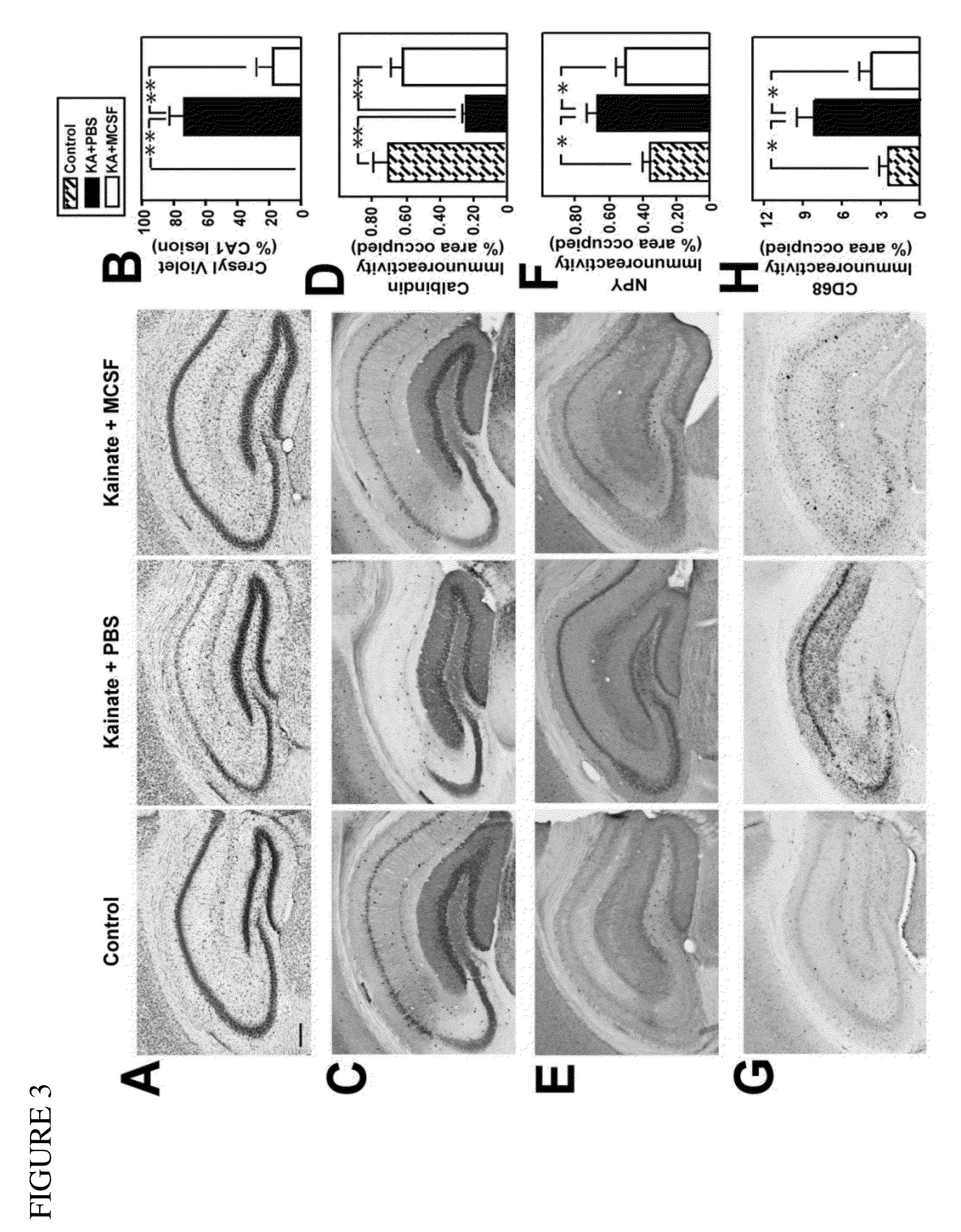 Methods of neuroprotection involving macrophage colony stimulating factor receptor agonists