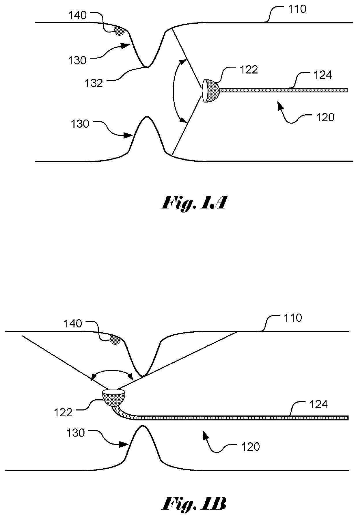 Method and Apparatus for Detecting Missed Areas during Endoscopy