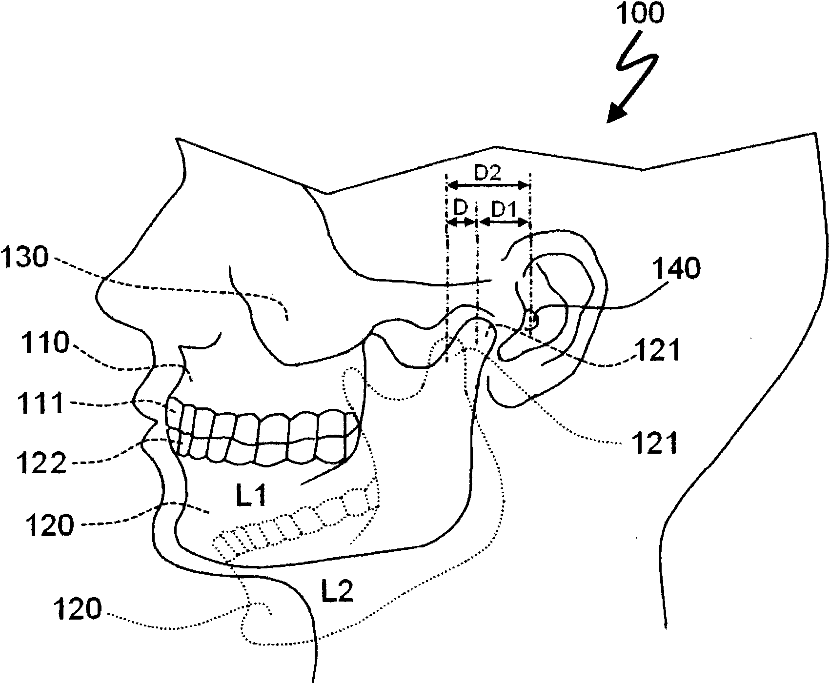 Auditory canal control device