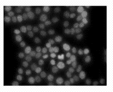 Method for preparing medicament-nanometer calcium phosphate composite system taking fat soluble photosensitizer as framework and application of system in preparation of medicaments for photodynamic therapy